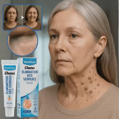 WartClean | Crème anti-verrues